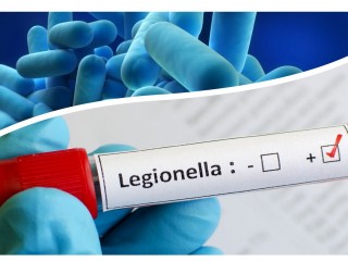 Legionela. Operaciones de mantenimiento higiénico-sanitario de las instalaciones de riesgo
