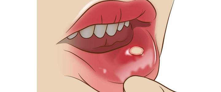 Curso en Dermatología Odontológica: Patología de la Mucosa Oral