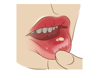 Curso en Dermatología Odontológica: Patología de la Mucosa Oral