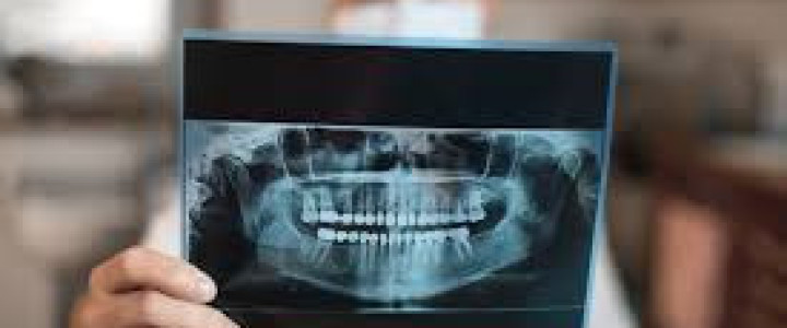 Curso gratis Especialista en Radiología para Higienistas Dentales online para trabajadores y empresas
