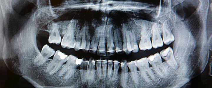 Técnico Profesional en Radiología Dental