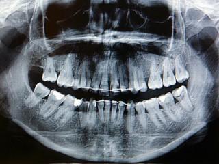 Técnico Profesional en Radiología Dental